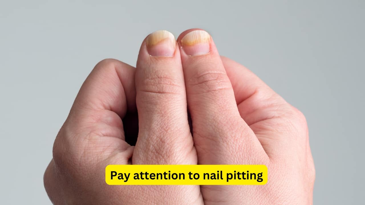 Pay attention to nail pitting Tiny dents in your nails, like someone poked them with a pin, may point to psoriasis. It’s more than a skin condition, it might also affect your joints. If you’ve got flaky skin, joint pain, and nail changes all at once, your body may be telling you it needs attention