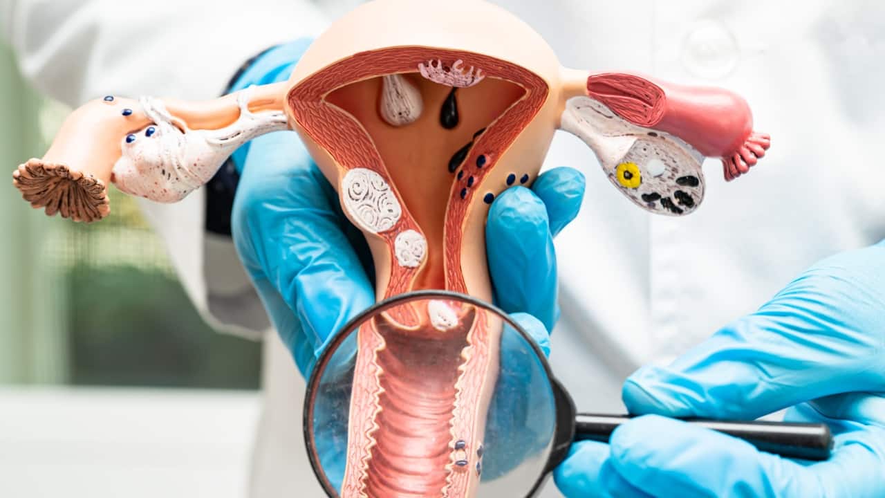 Types of Prolapse There may different types of pelvic organ prolapse. In case of the vagina, laxity of the anterior vaginal wall can cause herniation of the bladder through this wall (cystocele). Posteriorly, the rectum may herniate through, leading to rectocele. The uterus may descend downwards and can even protrude out of the introitus.