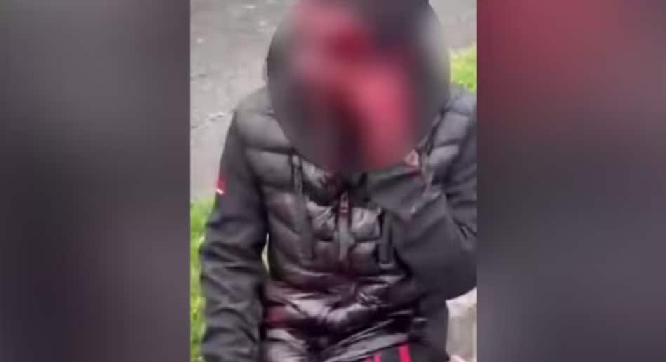 'Attackers could've killed him': Woman who rescued Indian man in Dublin says he was 'stripped and bleeding'