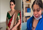 Explained - Uorfi Javed gets her lip-filler dissolved: Here's all you need to know about lip-job and why celebs can’t get enough