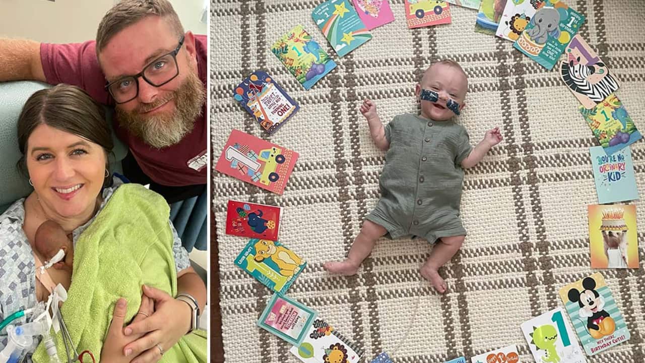 Born at just 21 weeks, world's most premature baby celebrates his 1st birthday with Guinness World Record