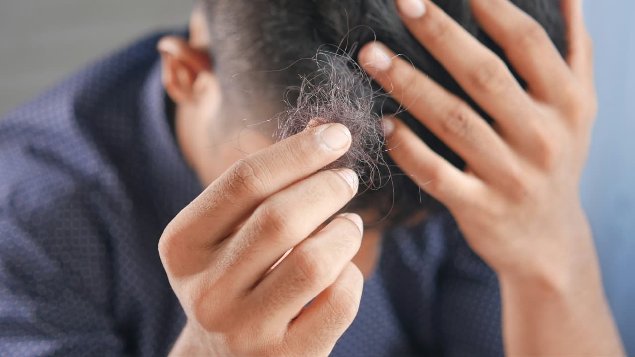 Hair loss may no longer be permanent, here's a no-pill, no -surgery, transplant-free solution Hair loss may no longer be permanent, here's a no-pill, no -surgery, transplant-free solution