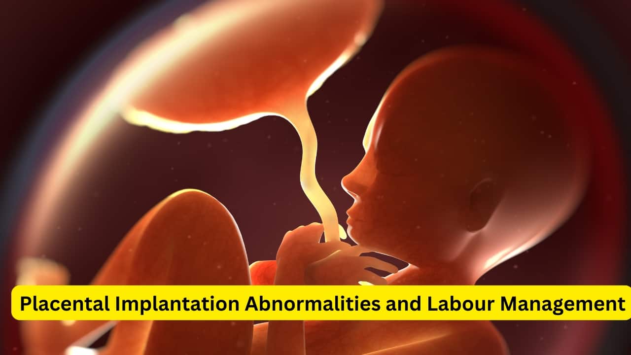 What is Postpartum Hemorrhage (Image: Canva)