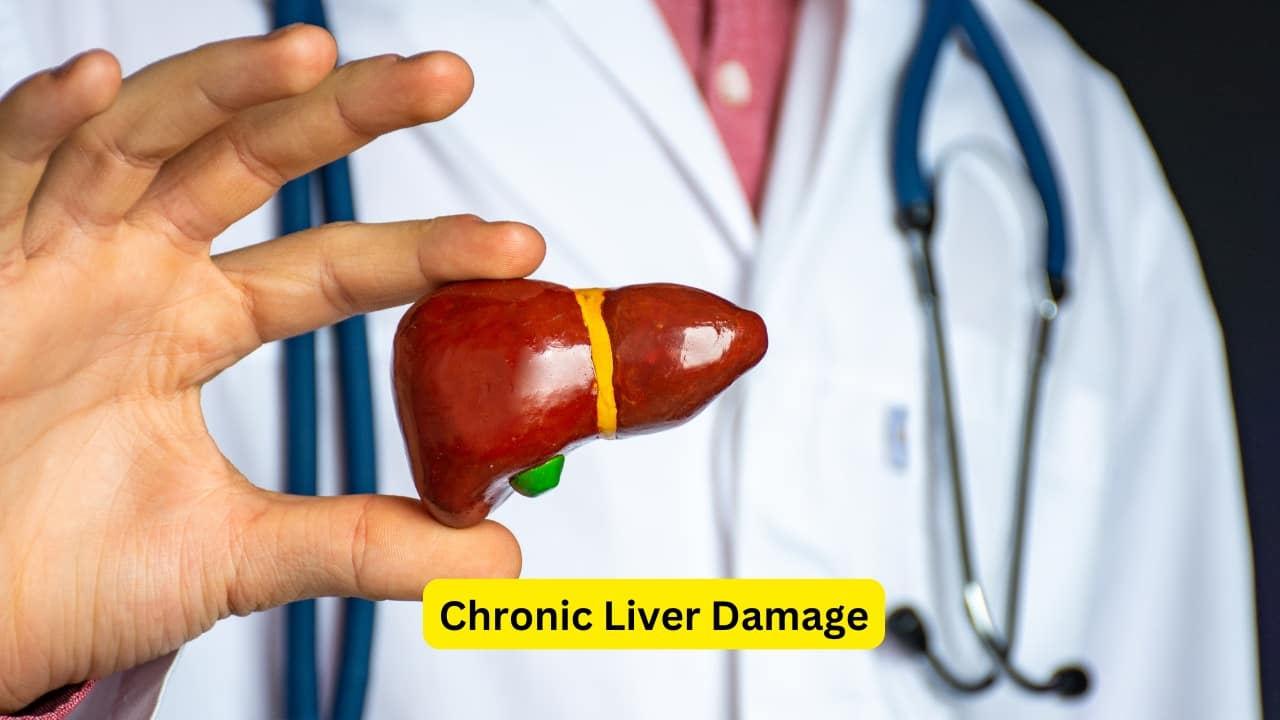 What is Hepatic Encephalopathy Liver Failure Toxin Build Up (Image: Canva) What is Hepatic Encephalopathy Liver Failure Toxin Build Up (Image: Canva)