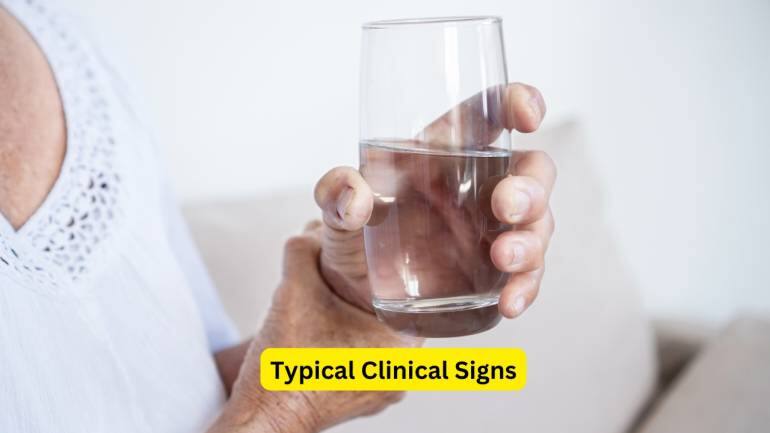 What is Hepatic Encephalopathy Liver Failure Toxin Build Up (Image: Canva) What is Hepatic Encephalopathy Liver Failure Toxin Build Up (Image: Canva)