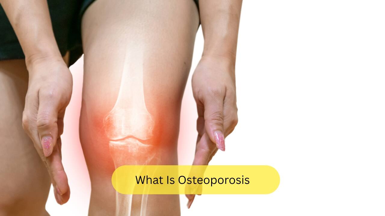 What Is Osteoporosis Osteoporosis is said to be the most common bone disorder. Characteristically, it shows low bone mass and the disorganisation of the micro-architecture of the bones. This enhances bone fragility and can lead to an increased risk of fractures. There exists an inverse relationship between bone mass density and risk of fractures in older adults. (Image: Canva)