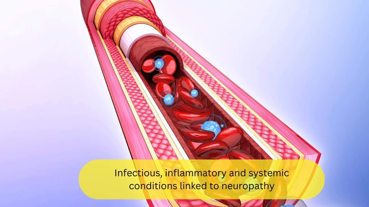 Infectious, inflammatory and systemic conditions linked to neuropathy Infectious and inflammatory conditions like HIV-AIDS, leprosy, and vasculitis (inflammation of the blood vessels) can cause poly-neuropathies. Co-morbidities like diabetes mellitus and renal failure contribute to this condition as well, and must be managed with adequate drugs and interventions.(Image : canva)