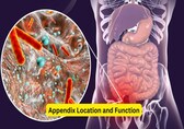 Appendicitis symptoms in adults, causes, and how to avoid rupture or abscess formation