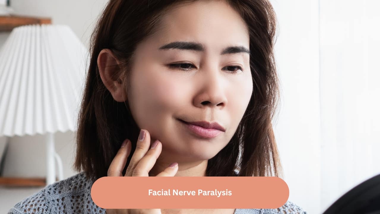 Facial Nerve Paralysis Ordinarily, the facial nerve is well protected in the bony canal. At times, the bony canal may be damaged, and the nerve comes to lie close to the middle ear mucosa. In such cases, inflammation of the middle ear can spread, thus leading to facial paralysis. It can fully recover if the acute episode of middle ear infection is controlled with antibiotics.(Image: Canva)