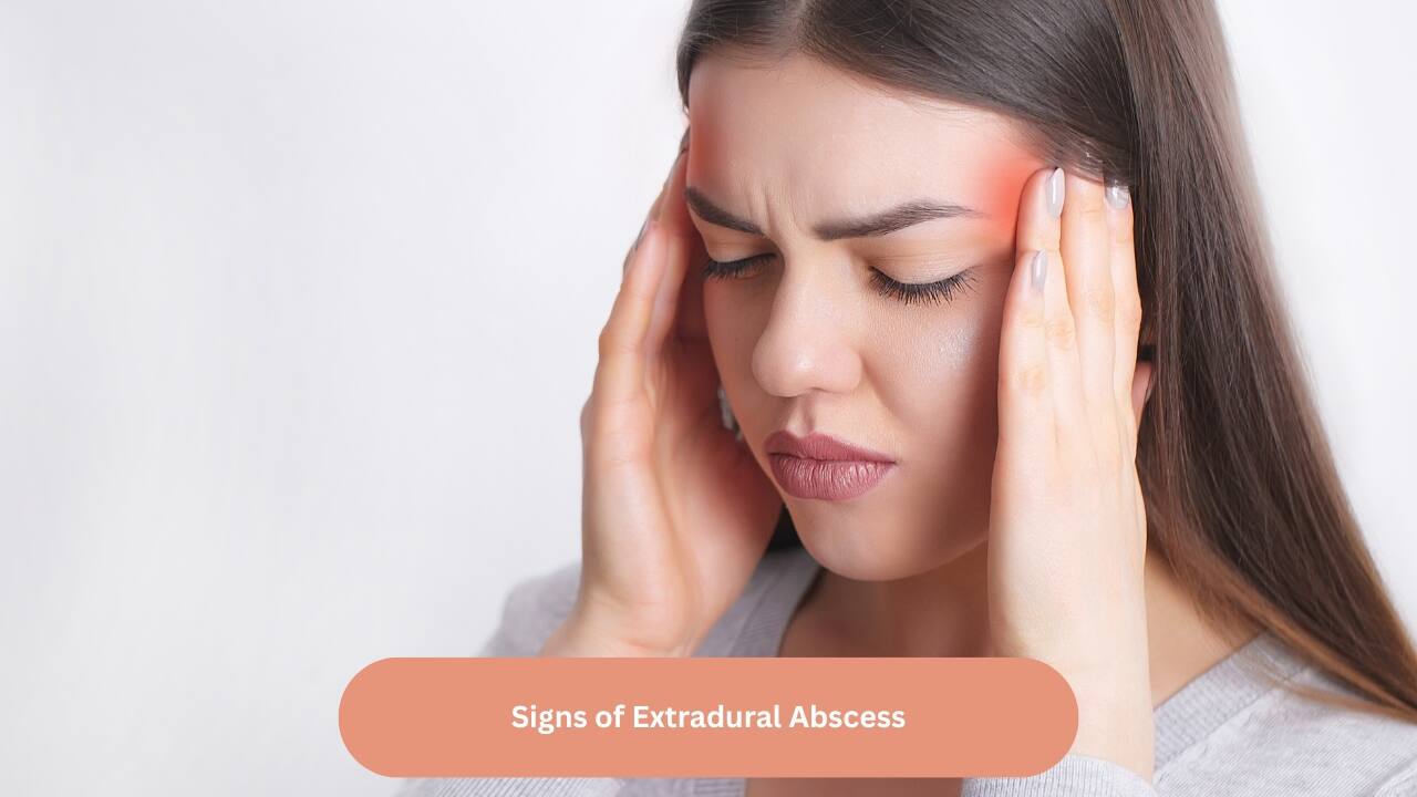 Signs of Extradural Abscess Persistent headache, severe pain in the ear, generalised weakness with a low grade fever and pulsatile pus-filled ear discharge may be seen if the person develops an extradural abscess. This can be diagnosed using a CT scan or an MRI. A surgery known as mastoidectomy may be needed to relieve these symptoms.(Image: Canva)   