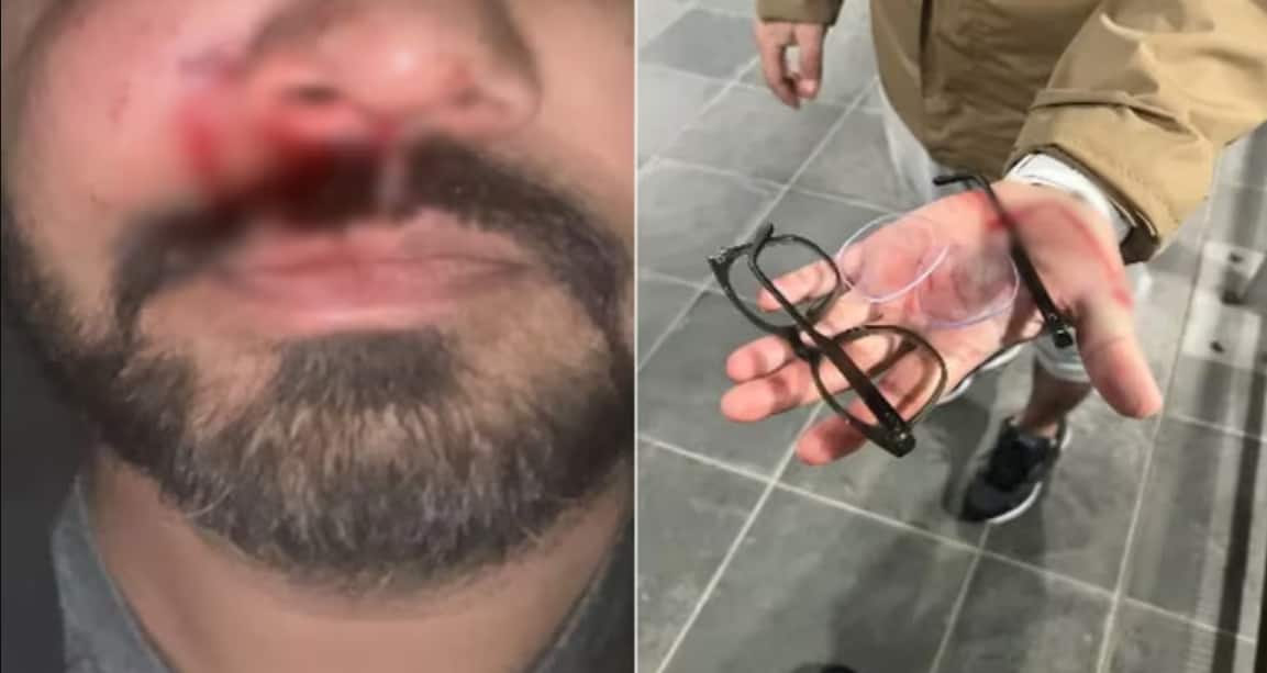 Indian-origin man alleges racist attack by teenagers in Dublin, suffers facial fracture