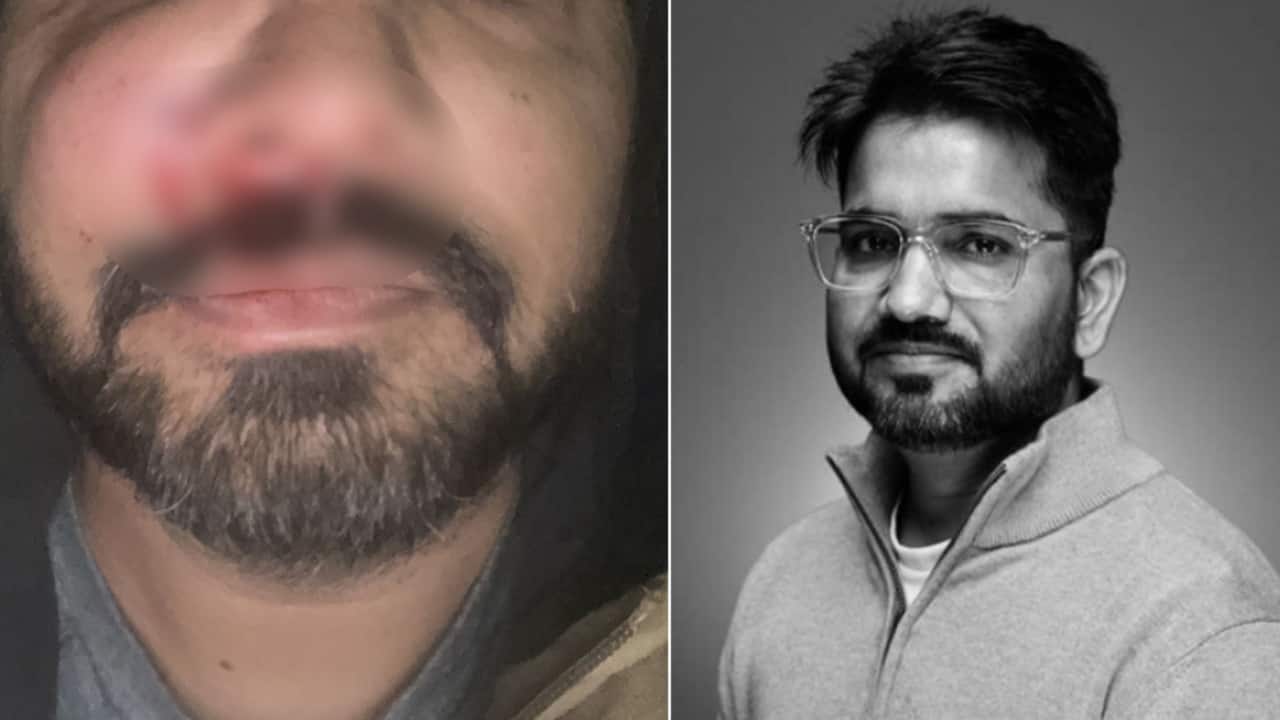Indian techie assaulted in Dublin: Are Irish gangs targeting Indians? Pattern of attacks raises alarm