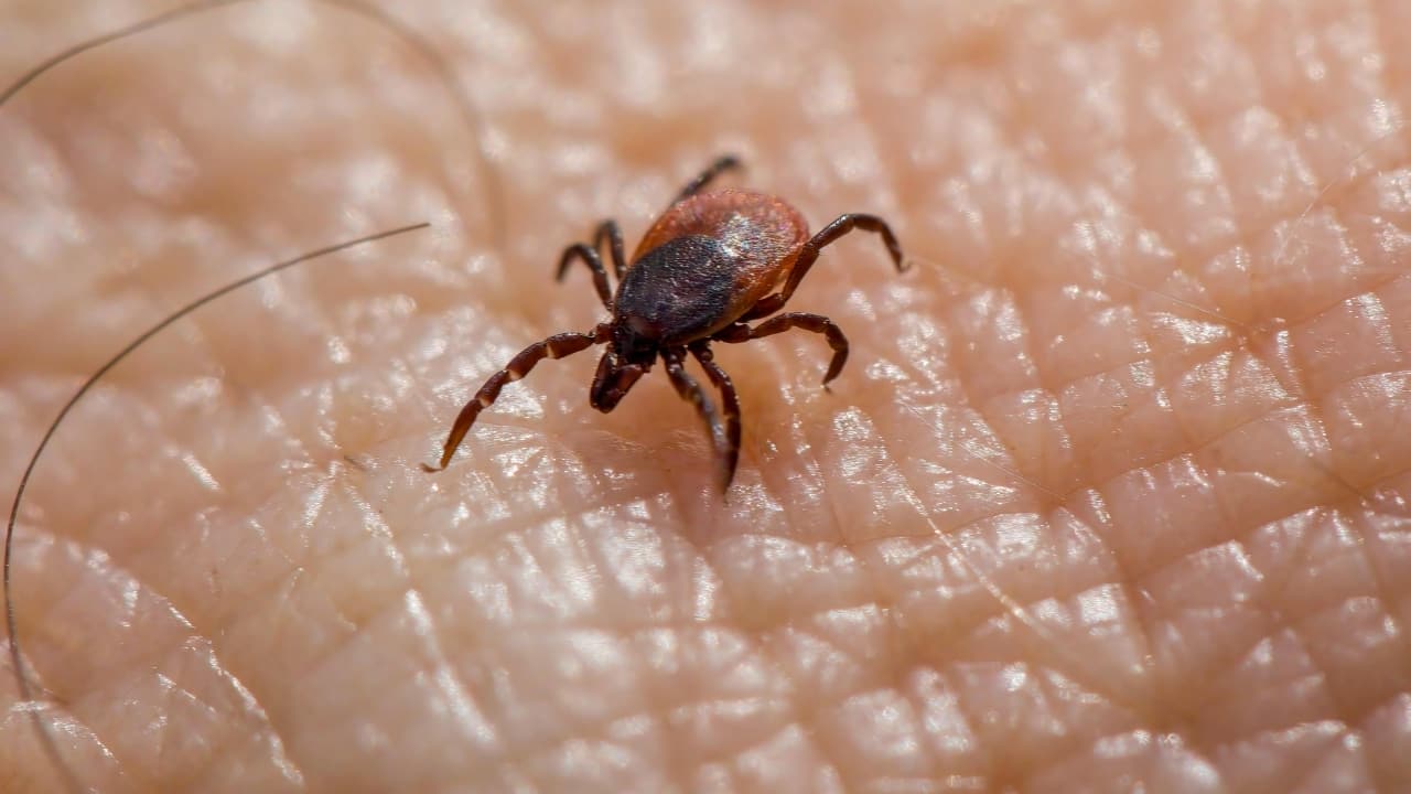 Lyme Disease: What you need to know about the cause, symptoms and prevention
