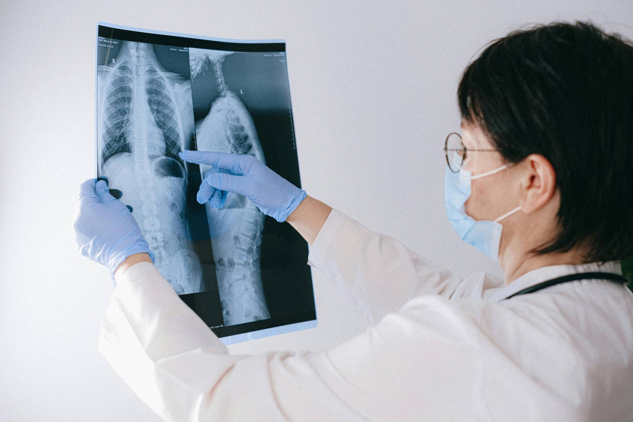 World Lung Day: Pulmonologist busts common myths about lung health
