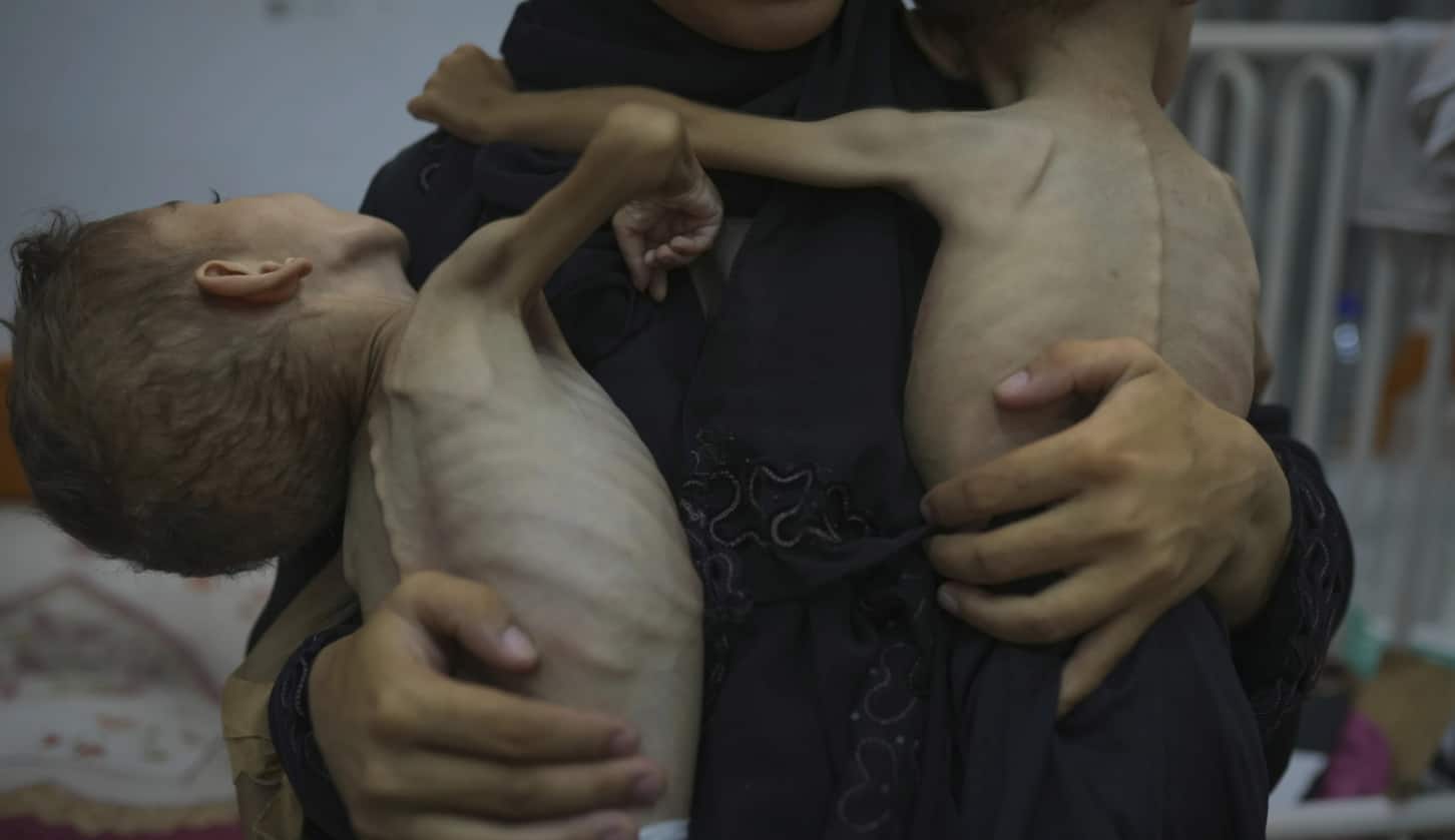 Omniya Mahra holds her sons Oday, 4, and Mohammed, 3, both battling malnutrition and health challenges amid Gaza’s ongoing crisis. (Image: AP) 