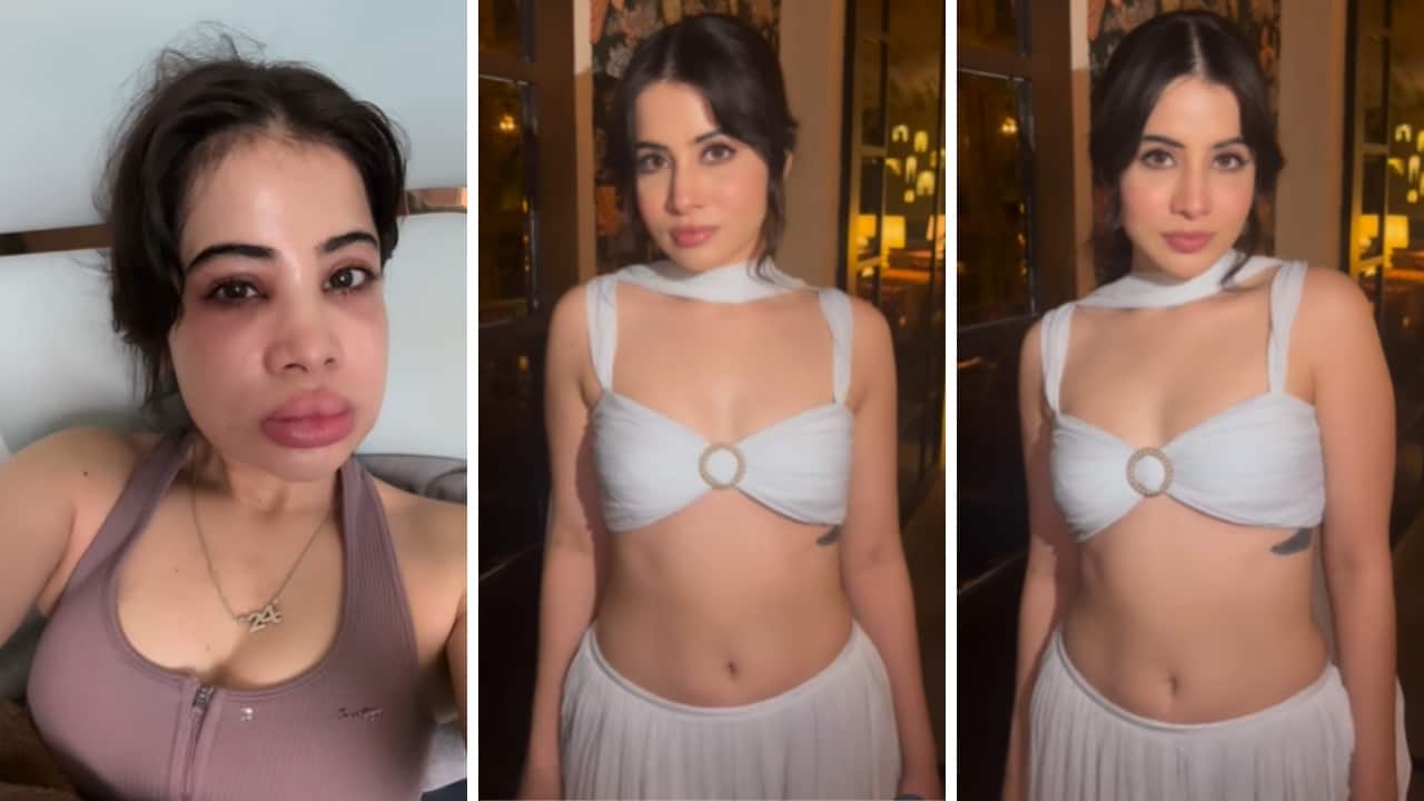 Uorfi Javed shares transformation reel after dissolving lip fillers, netizens call her ‘pretty’