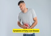 Symptoms of fatty liver on your skin, and how to fix it 