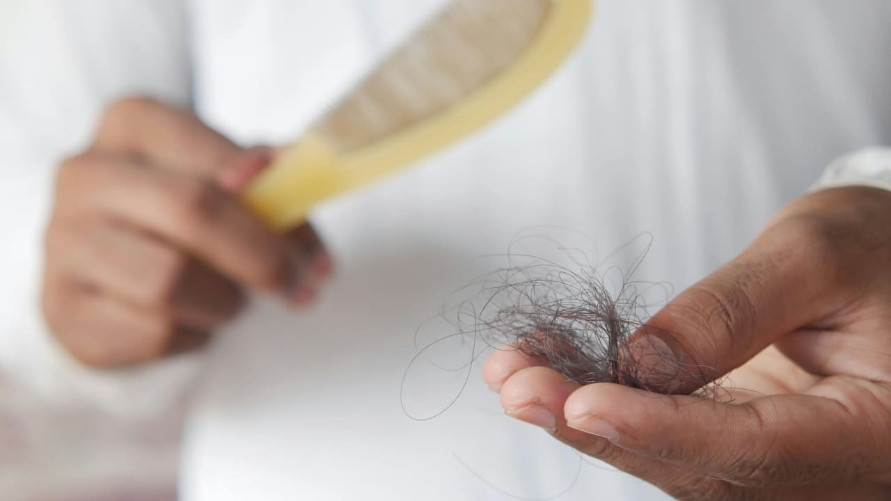 Causes of baldness: Best expert tips to stop hair loss naturally, control damage