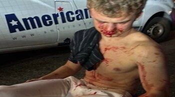 A bloodied photo of Coristine, shirtless with visible injuries, was posted online by former colleague Marko Elez.