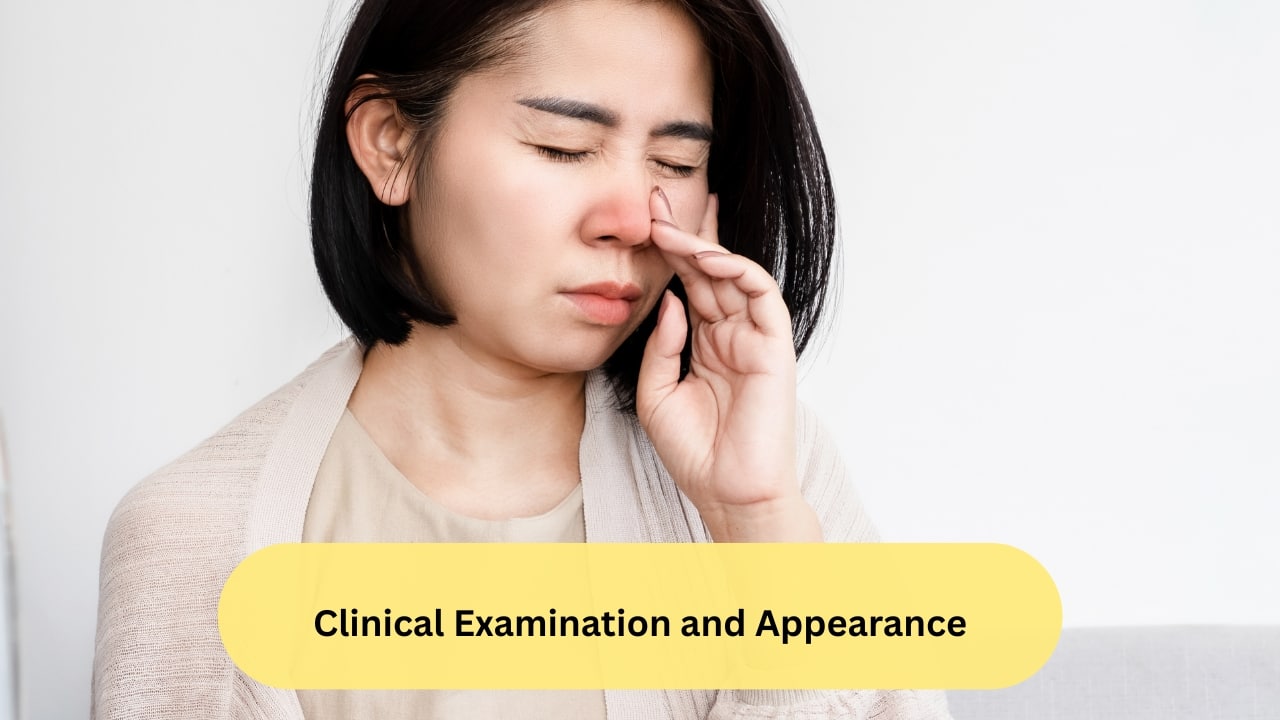 Clinical Examination and Appearance Depending on the size and the position of the nasal polyp, it may protrude as a mass from the nostril. On observation by a healthcare provider through a procedure called anterior rhinoscopy, pale, glistening, grape-like masses may be seen, which do not bleed on touch.(Image: Canva)