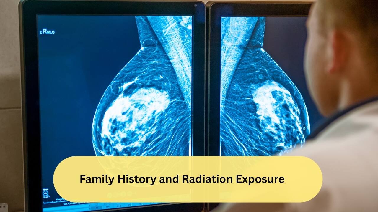 Family History and Radiation Exposure A detailed family history will be taken by the healthcare provider, especially about first-degree relatives (mother/sister). If a first-degree relative has breast cancer, the risk is three to five times more than normal. Therapeutic exposure to radiation (especially for conditions like Hodgkin’s lymphoma) can predispose to carcinoma breast (especially when given at a younger age).(Image: Canva) 