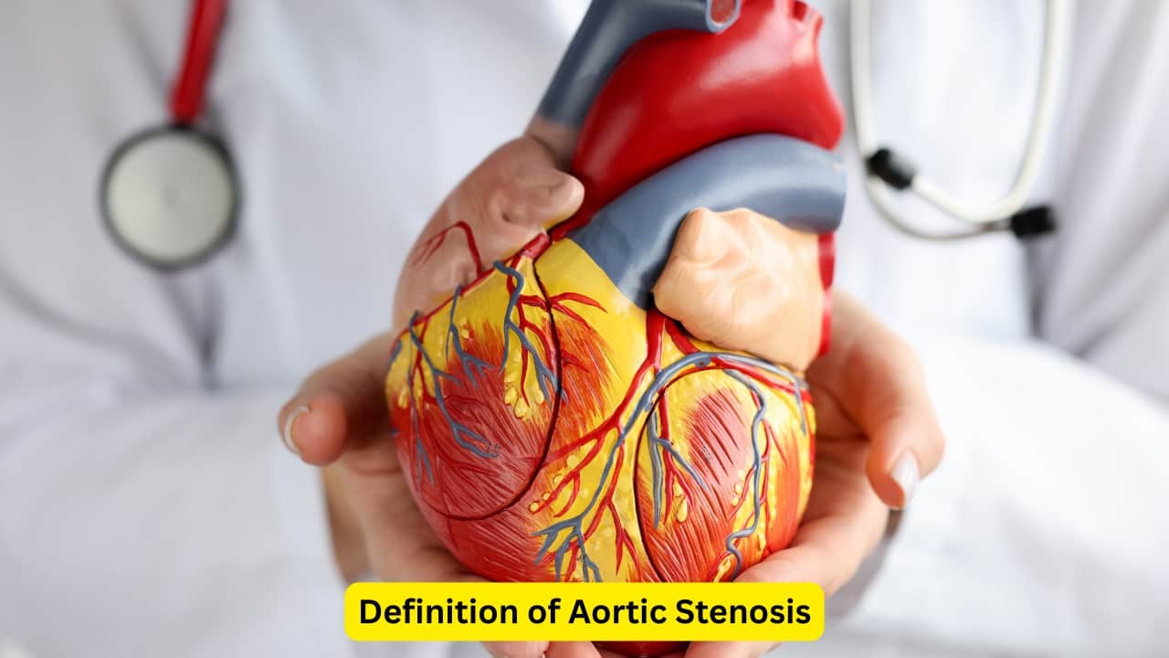 Definition of Aortic Stenosis A long-term progressive disease that results in the narrowing of the aortic valve is termed as aortic stenosis. This narrowing makes it difficult for the valve to open completely, thus reducing the amount of blood entering the large blood vessel known as the aorta.(Image: Canva) 