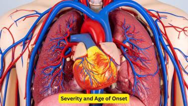 Severity and Age of Onset The normal area of the aortic valve is around 3-4 squared centimetres. However, critical aortic stenosis can develop when this area becomes less than 0.8 squared centimetres. The age at which this commonly occurs is 50 to 70 years, but it can also be seen in people after 40 years of age.(Image: Canva) 