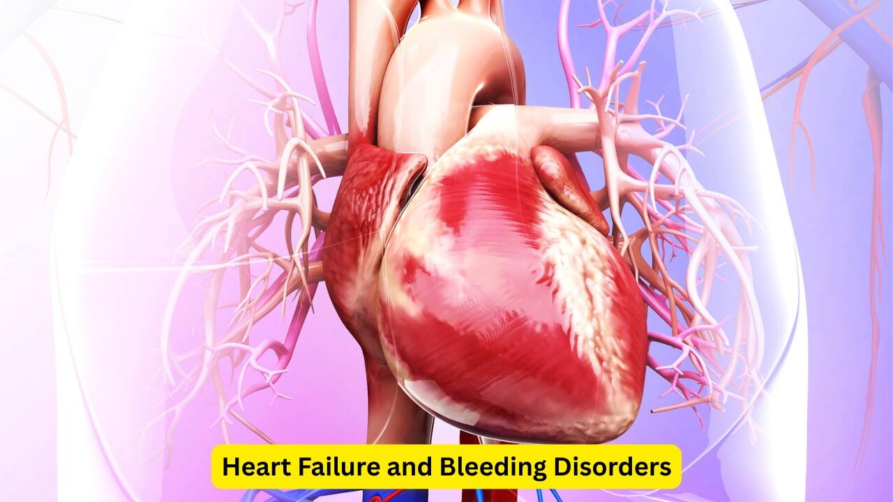 Heart Failure and Bleeding Disorders Aortic stenosis can also lead to heart failure, with symptoms like orthopnea and paroxysmal nocturnal dyspnea, where the person experiences a sudden shortness of breath and coughing, causing them to wake up in the middle of the night when they are asleep. They may also experience gastrointestinal bleeding due to bleeding disorders (with aortic stenosis).(Image: Canva) 