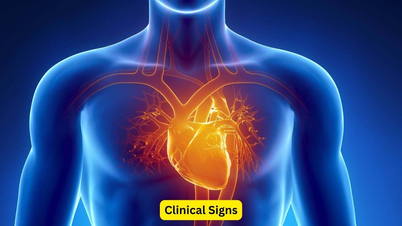 Clinical Signs A person who has aortic stenosis may have a pale skin, and an asthenic look. Changes may also be seen in the pulse and the blood pressure by the healthcare provider. A certain heart murmur may be heard using a stethoscope, due to the presence of a diseased valve.(Image: Canva)