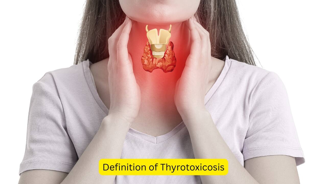 Definition of Thyrotoxicosis Increased levels of circulating thyroid hormones T3 and T4 can lead to a state known as thyrotoxicosis. This increase is either attributed to destruction of the thyroid gland or a different source (other than the thyroid) secreting these hormones. A number of causes can lead to thyrotoxicosis.(Image: canva)   
