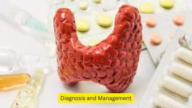 Diagnosis and Management The healthcare provider must be consulted if such symptoms are seen. They may advise certain laboratory investigations like free T3 and T4 levels, along with TSH levels. Certain antibodies may also be tested for, like the TSH receptor antibody. Medical and surgical management may be recommended.(Image: canva)  Disclaimer: This article, including health and fitness advice, only provides generic information. Don’t treat it as a substitute for qualified medical opinion. Always consult a specialist for specific health diagnosis