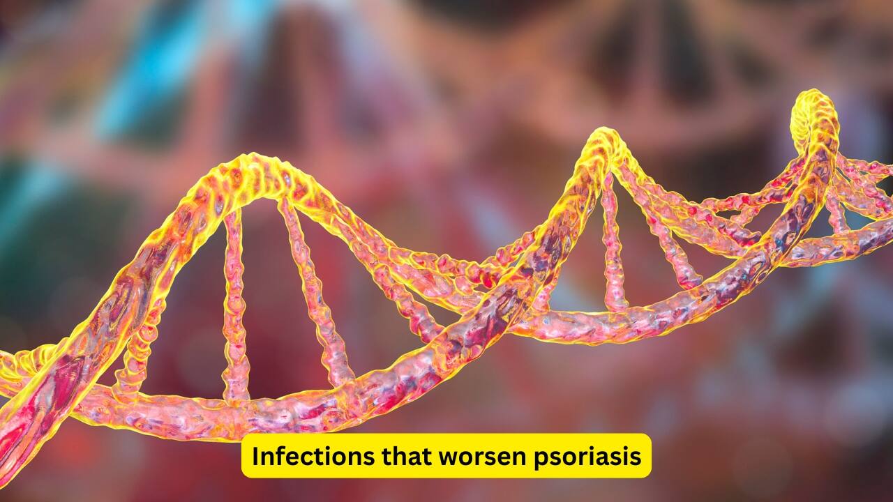 Infections that worsen psoriasis Symptoms of psoriasis may become worse due to a combination of genetic factors and infections by streptococcus, HIV, and certain medications. The identification of individual triggers alongside guidance by the healthcare provider may aid in better prevention of flares and symptomatic management.(Image: Canva)