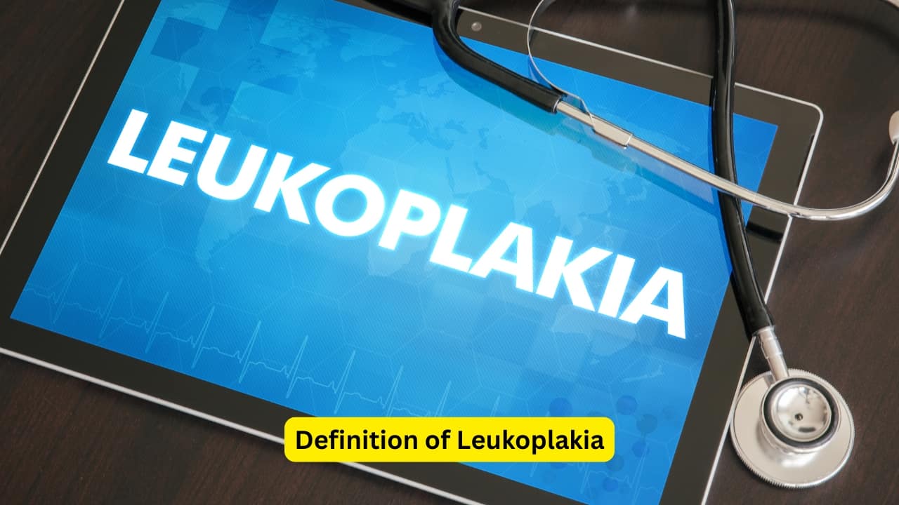10 facts about leukoplakia: Characteristics, risk factors, and management