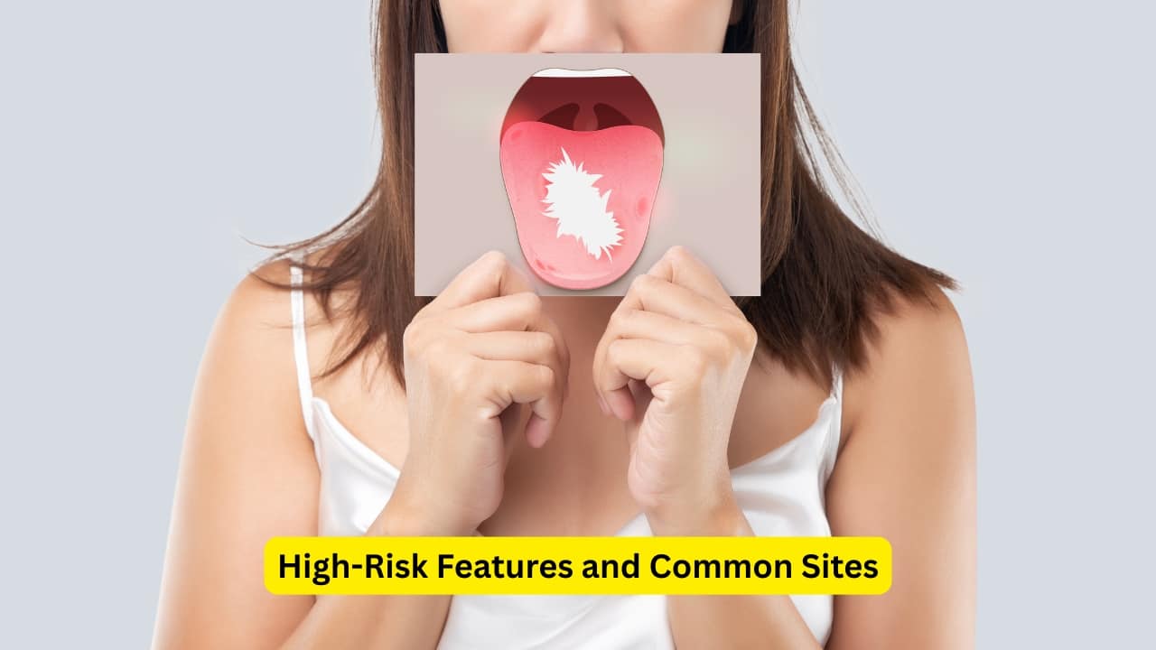 High-Risk Features and Common Sites High-risk potential is seen in types that show more ulcerations, erosions, and are hard and indurated. These lesions are commonly seen in areas like the cheek, tongue, and gums. However, these lesions are often painless and non-tender, and may be ignored by the affected individuals.(Image: Canva)