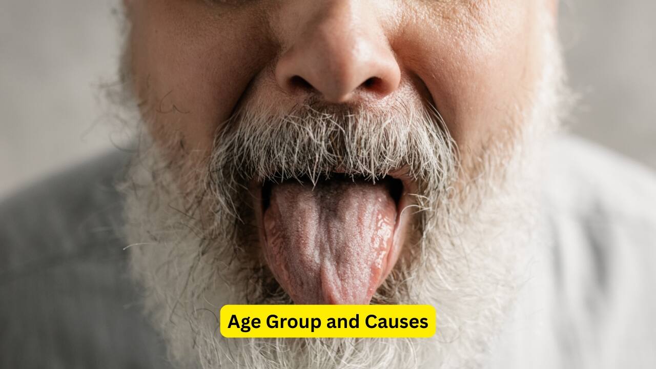 Age Group and Causes The age group that leukoplakia is often seen is beyond forty years. There are certain causes that predispose an individual to developing leukoplakia. One of the most crucial causes or influences includes smoking. Continuous use of nicotine worsens this condition.(Image: Canva)
