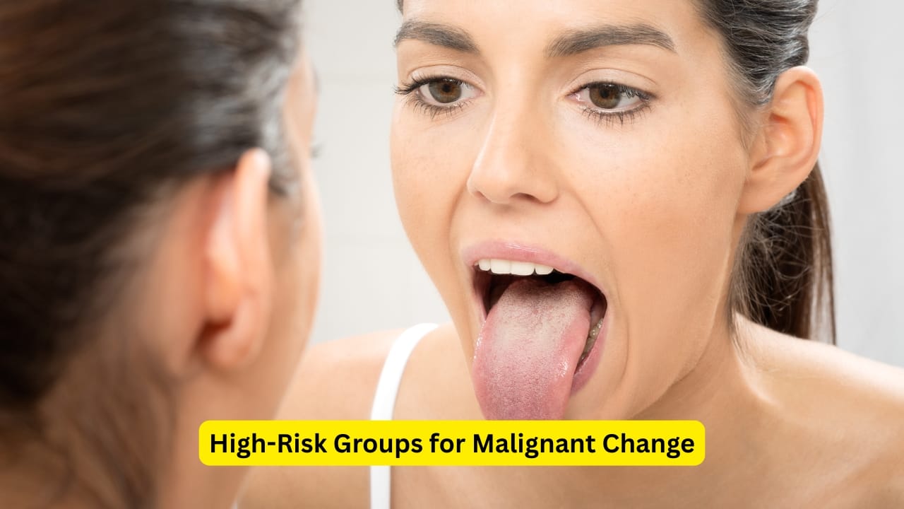 High-Risk Groups for Malignant Change People who have a high risk of having their leukoplakia turn into malignancy include the elderly and younger females. If the white patches are present in the floor of the mouth or the tongue, they are also more likely to transform into a malignancy.(Image: Canva)