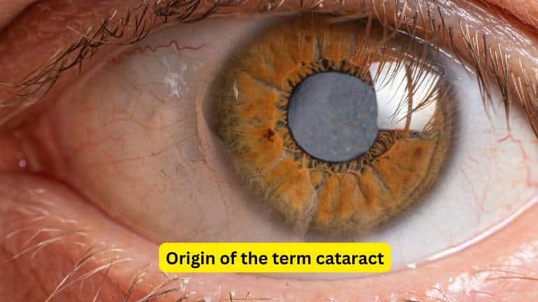 Cataract Causes, Risk Factors, Symptoms and Management (Images: Canva)