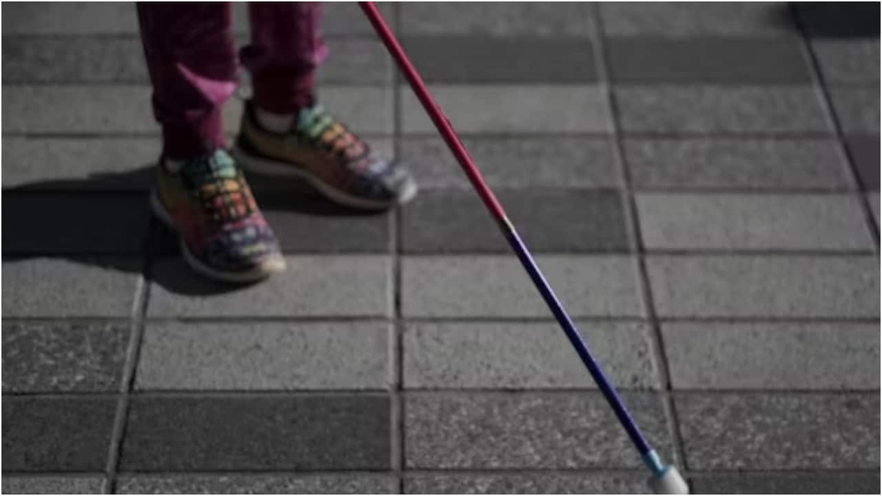 Canadian woman sees again after decade thanks to rare 'tooth-in-eye' surgery. Here's what it is