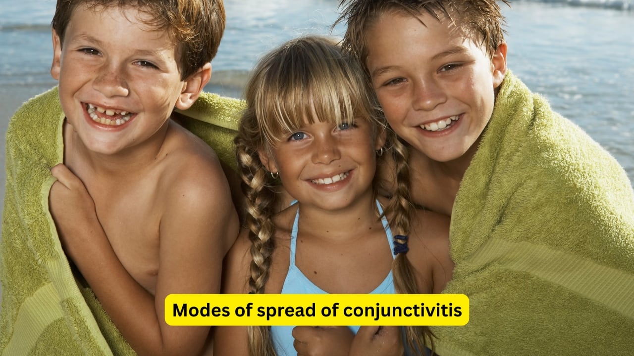 Modes of spread of conjunctivitis Infection may spread from one person to another by close contact, or through the air. Water-borne infections are common as well, and flies can also lead to transmission. Infected materials and common handkerchiefs and towels may also increase the chances of infection.(Image: Canva)