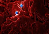 Urinary tract infection symptoms, causes and prevention tips