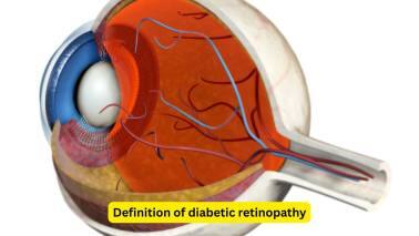 Definition of diabetic retinopathy Diabetic retinopathy refers to the retinal changes seen in people with diabetes mellitus, and is one of the common reasons, especially in Western countries, for blindness. The incidence of diabetic retinopathy is slowly on the rise, and appropriate attention is needed before complications occur.(Image: Canva)