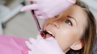Causes of oral cancer in youngsters: Lifestyle risks, late diagnosis, and how to fight back