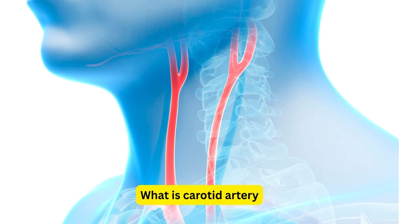 What is carotid artery A number of arteries are present in the neck, of which one of the important ones is the carotid artery. A carotid artery aneurysm refers to a bulge in this blood vessel. A common cause for this is atherosclerosis (build-up of fats and cholesterol in the arterial walls). While some people may not have any symptoms, others may feel a throbbing lump. (Image : Canva)