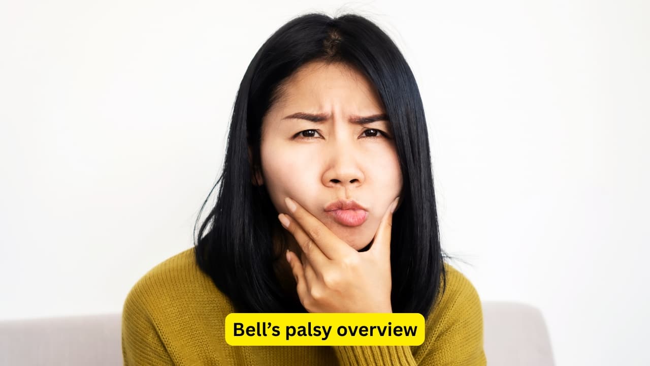 Bell’s palsy overview One of the most common forms of facial paralysis on one side of the face is Bell’s palsy. The main cause has been found to be latent herpes viruses (previous infection with herpes simplex virus type 1 or herpes zoster virus). These latent viruses may get reactivated, and cause swelling of the nerve.(Image : Canva)