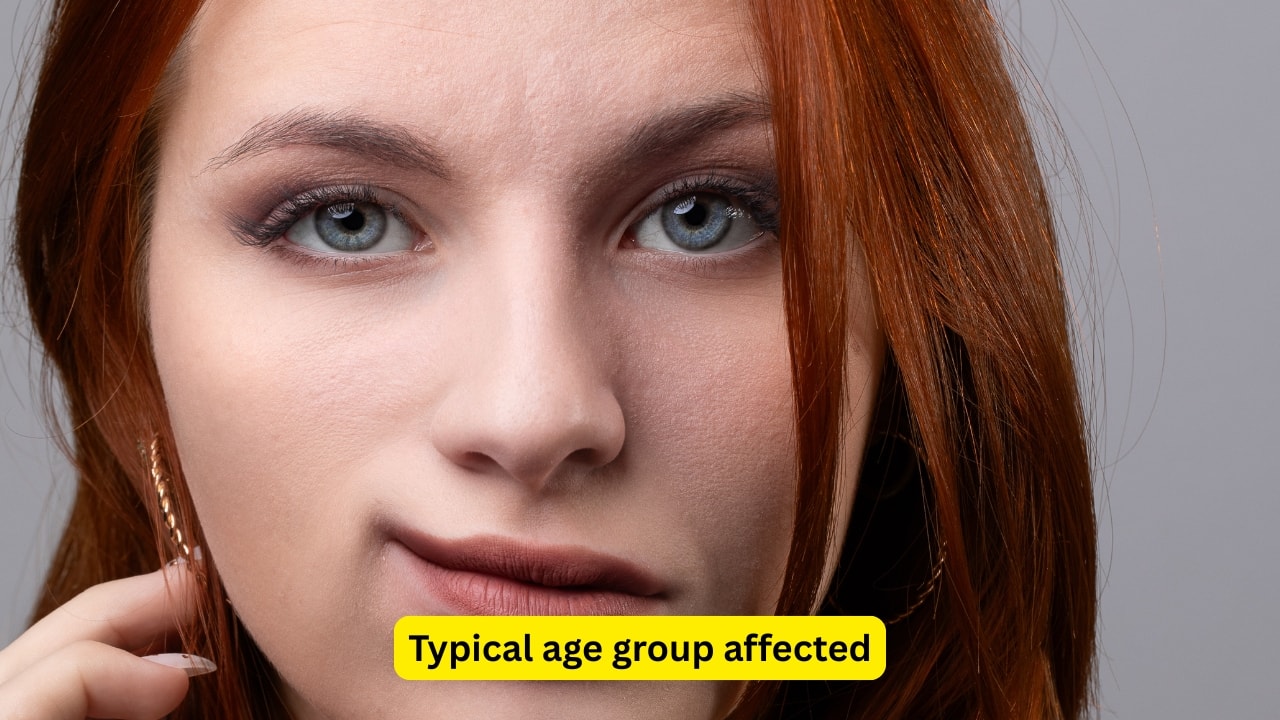Typical age group affected Bell’s palsy is more common in the age group of fifteen to forty-five years, but there is no gender difference. The onset of symptoms is often abrupt, and pain around the ear is a usual complaint of people with Bell’s palsy. A history of exposure to cold may be elicited.(Image : Canva)