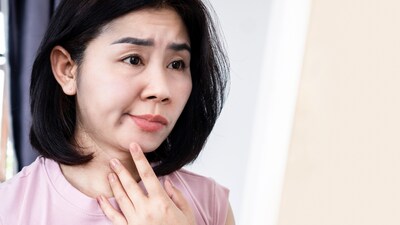 Sudden facial weakness? Everything to know about facial nerve palsy: Causes, symptoms, and management