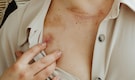 What is textile dermatitis? How synthetic fabrics like polyester and nylon can irritate your skin