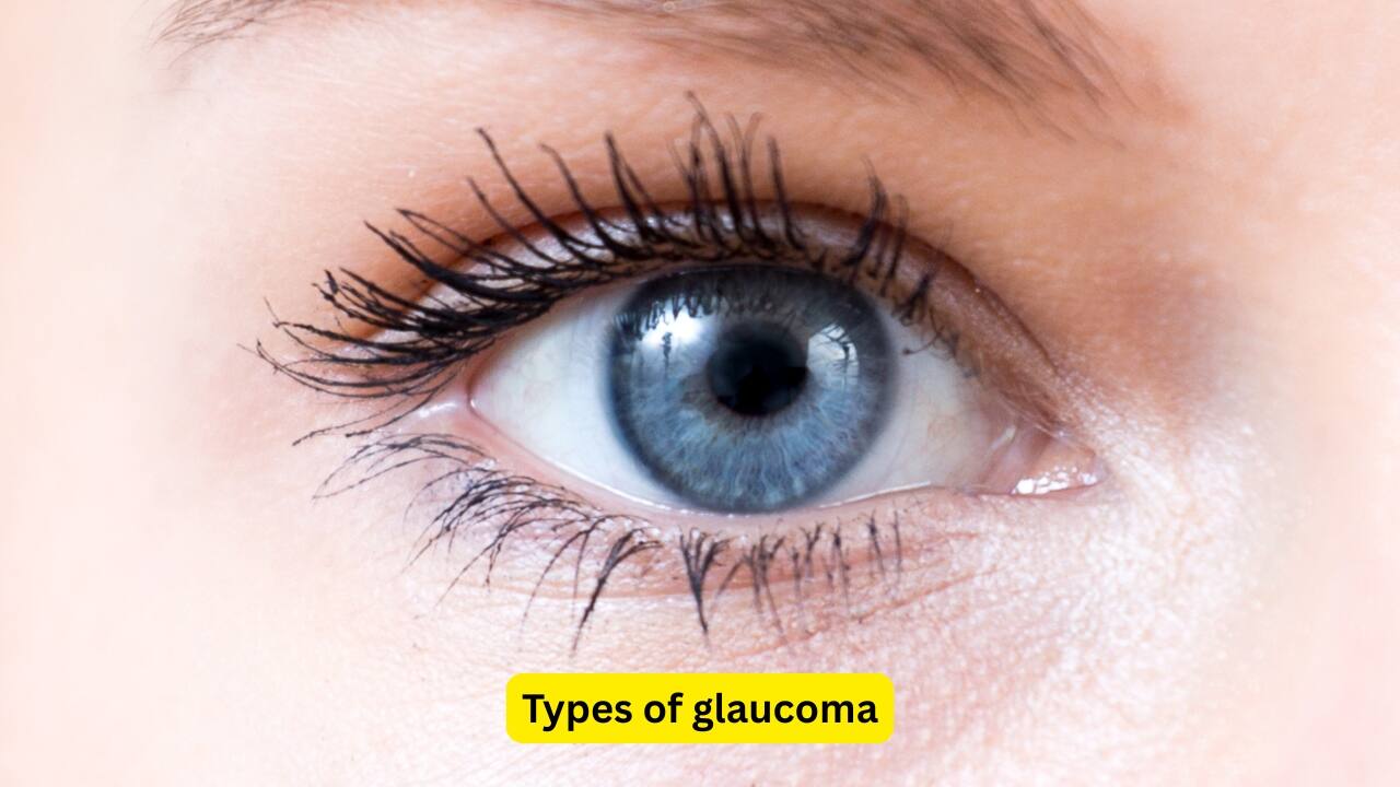 Types of glaucoma Glaucoma may be present since birth, called primary congenital glaucoma, or it may develop with other associated anomalies. Glaucoma has other types too, like open angle, angle closure, and mixed mechanism glaucoma. Secondary glaucomas are also seen in some people.(Image: canva)
