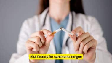 Risk factors for carcinoma tongue Risk factors for the development of carcinoma tongue include cigarette smoking, excessive alcohol consumption, and diseases like syphilis. Consumption of spicy foods and having a sharp tooth that hurts the oral mucosa may also play a role in this condition.(Image: Canva)