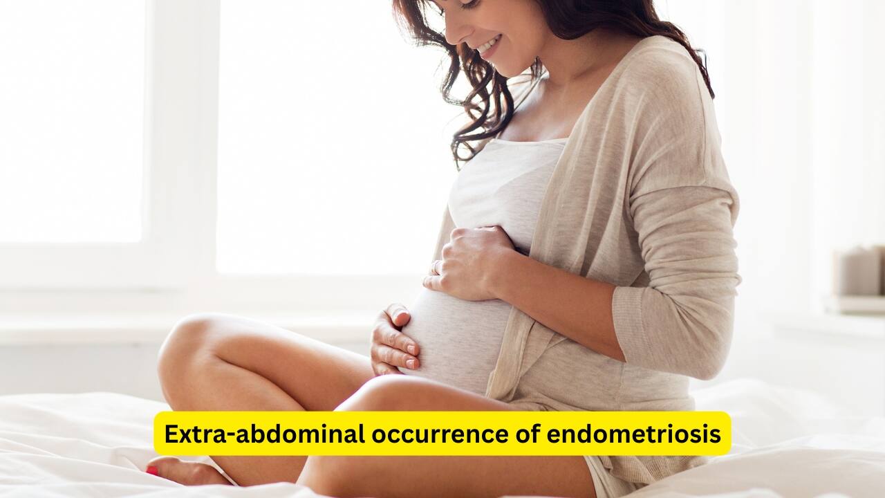 Extra-abdominal occurrence of endometriosis Risk factors for endometriosis include low parity (less number of viable pregnancies), delayed child bearing and a family history of endometriosis. Other factors like genital tract obstruction and environmental toxins have also been found to play a role.(Image: Canva) 